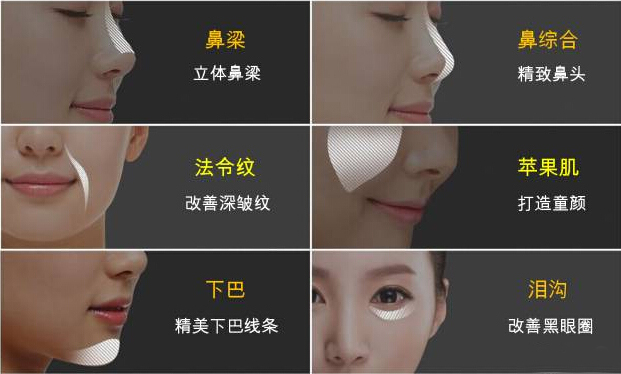 /Public/ueditor/php/upload/image/20171117/1510908502137838.jpg