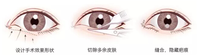 /Public/ueditor/php/upload/image/20171121/1511255149196842.jpg