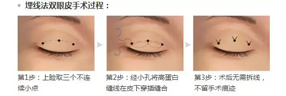 /Public/ueditor/php/upload/image/20171122/1511340492983962.jpg