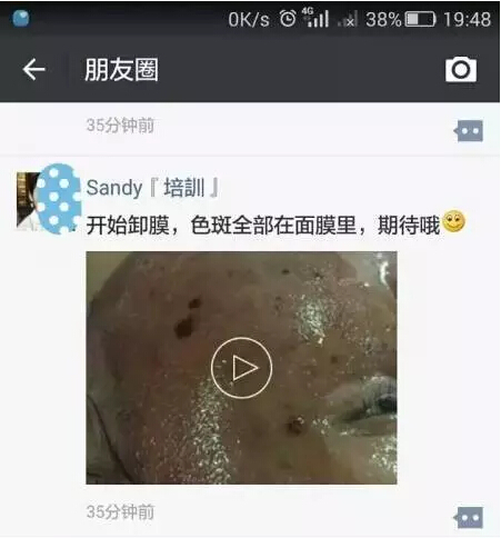 /Public/ueditor/php/upload/image/20171211/1512977621975156.jpg
