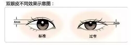 /Public/ueditor/php/upload/image/20171225/1514187573451817.jpg
