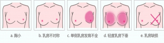 /Public/ueditor/php/upload/image/20180124/1516781910667488.jpg