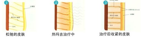 /Public/ueditor/php/upload/image/20180302/1519982429280862.png