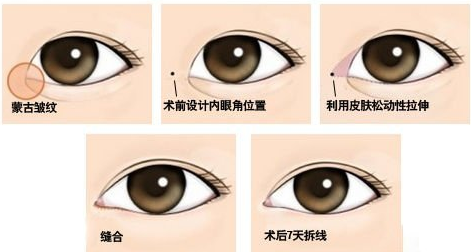 /Public/ueditor/php/upload/image/20180303/1520068083762522.png