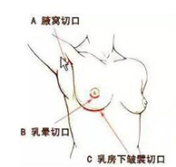 /Public/ueditor/php/upload/image/20180322/1521710857137975.png