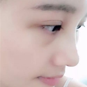/Public/ueditor/php/upload/image/20180405/1522920517819949.png