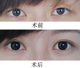 /Public/ueditor/php/upload/image/20180516/1526462376126268.png