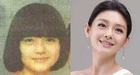 保妥适瘦脸