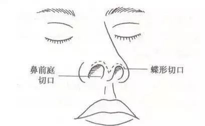 /Public/ueditor/php/upload/image/20180627/1530091182503185.jpg