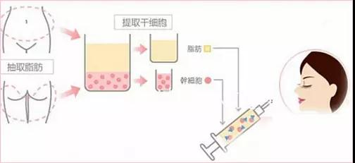 /Public/ueditor/php/upload/image/20180707/1530955760330009.jpg