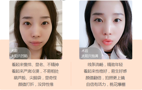/Public/ueditor/php/upload/image/20180817/1534472922515674.png