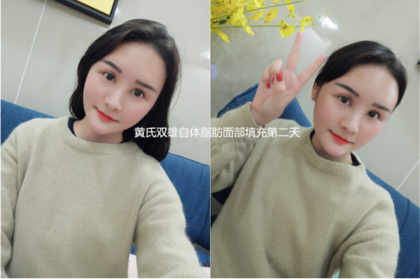 /Public/ueditor/php/upload/image/20180829/1535528553664660.png