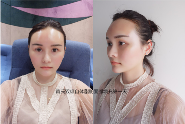 /Public/ueditor/php/upload/image/20180829/1535528575750968.png