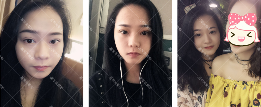 /Public/ueditor/php/upload/image/20180903/1535958762804252.png