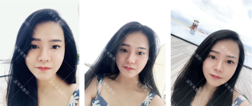 /Public/ueditor/php/upload/image/20180903/1535958775807703.png
