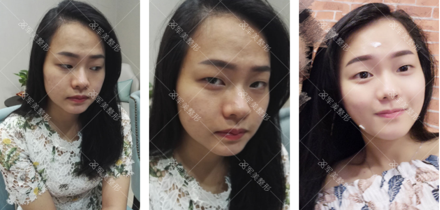 /Public/ueditor/php/upload/image/20180903/1535958791437157.png
