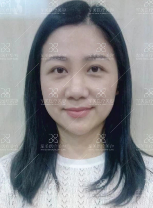 /Public/ueditor/php/upload/image/20180903/1535959095894334.png