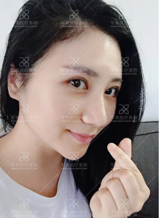 /Public/ueditor/php/upload/image/20180903/1535959148114144.png