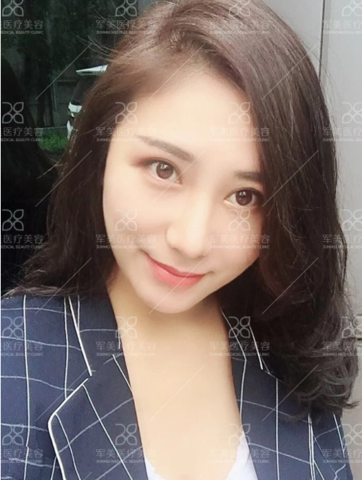 /Public/ueditor/php/upload/image/20180903/1535959224852509.png