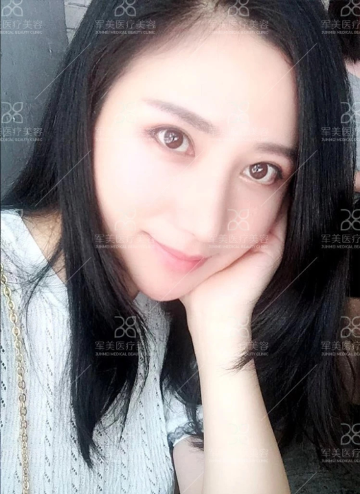 /Public/ueditor/php/upload/image/20180903/1535959236496065.png