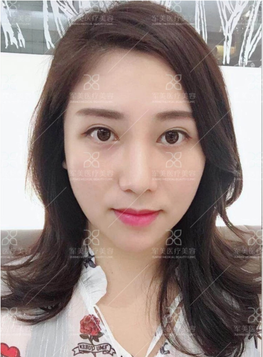/Public/ueditor/php/upload/image/20180903/1535959292934545.png