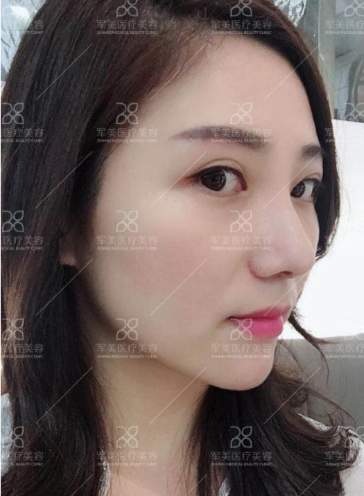 /Public/ueditor/php/upload/image/20180903/1535959306239582.png