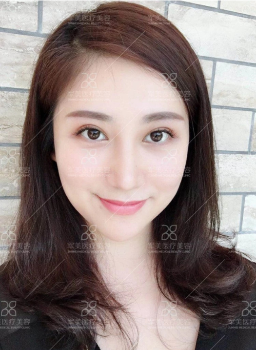 /Public/ueditor/php/upload/image/20180903/1535959445841252.png