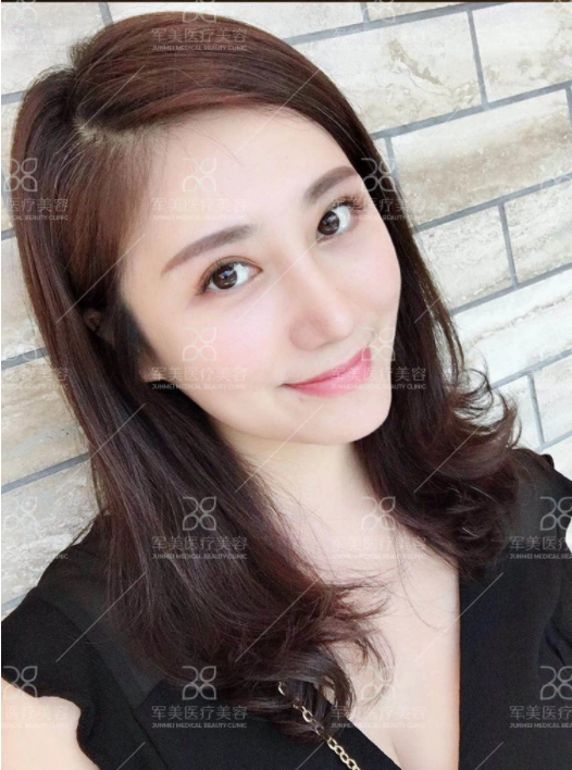 /Public/ueditor/php/upload/image/20180903/1535959458402033.png