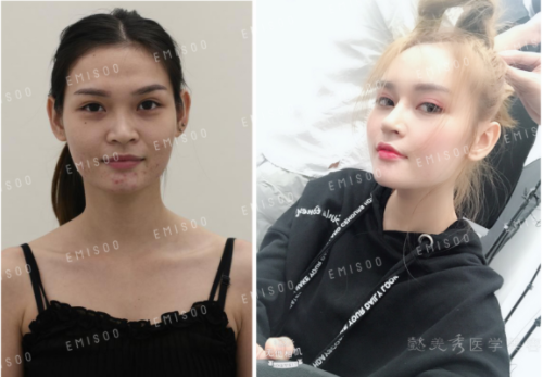 /Public/ueditor/php/upload/image/20180905/1536132225990705.png