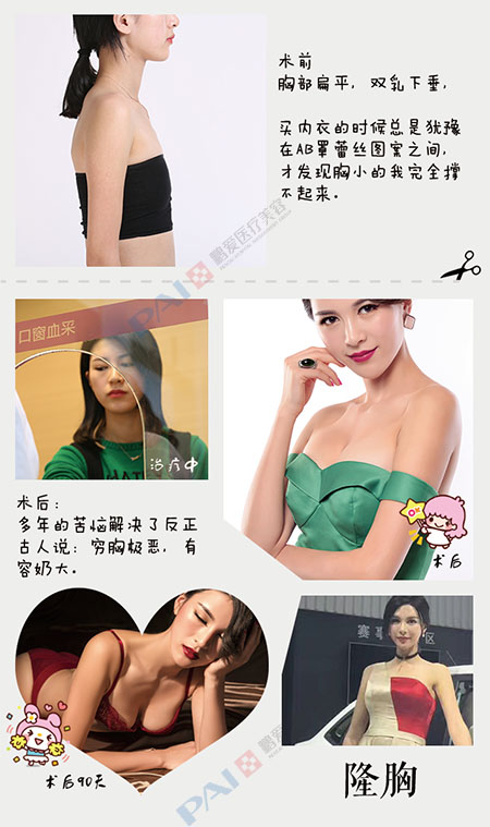 /Public/ueditor/php/upload/image/20180911/1536652224425740.jpg
