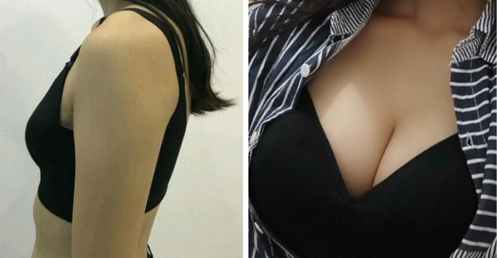 /Public/ueditor/php/upload/image/20180913/1536818884609161.png
