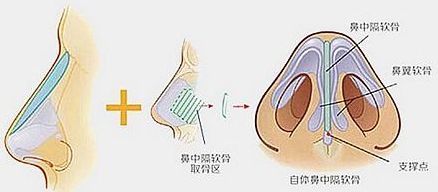 /Public/ueditor/php/upload/image/20180921/1537495279570841.jpg