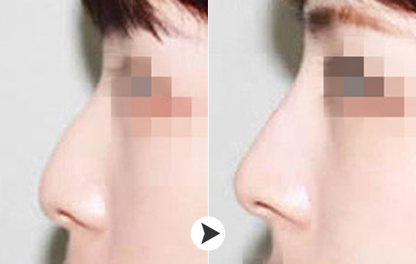 /Public/ueditor/php/upload/image/20180921/1537517922602983.jpg