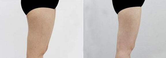/Public/ueditor/php/upload/image/20180924/1537766607125734.png