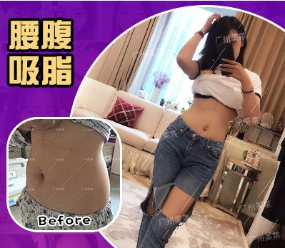 /Public/ueditor/php/upload/image/20180929/1538226195167781.png