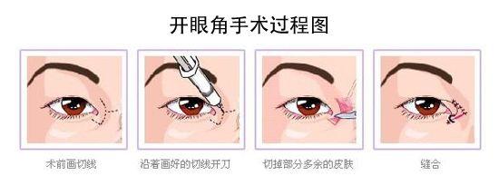 /Public/ueditor/php/upload/image/20181007/1538898334653487.jpg