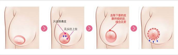 /Public/ueditor/php/upload/image/20181010/1539158442984037.png