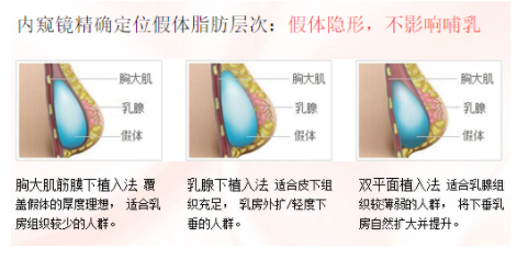 /Public/ueditor/php/upload/image/20181010/1539159761564193.png