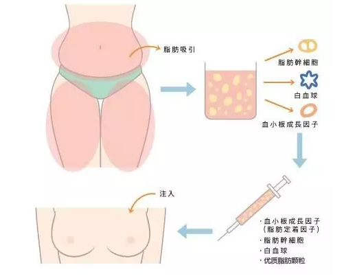 /Public/ueditor/php/upload/image/20181012/1539329990278781.png