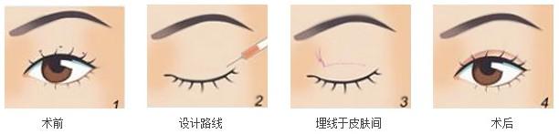 /Public/ueditor/php/upload/image/20181018/1539847502580584.jpg