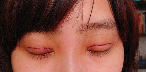 /Public/ueditor/php/upload/image/20181018/1539847731701821.jpg