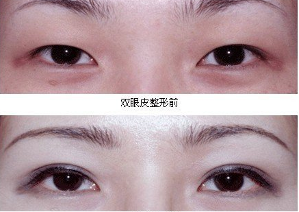 /Public/ueditor/php/upload/image/20181024/1540369099648615.png