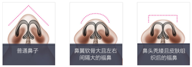 /Public/ueditor/php/upload/image/20181029/1540785017353464.png