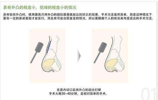 /Public/ueditor/php/upload/image/20181029/1540791457408968.jpg