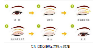 /Public/ueditor/php/upload/image/20181030/1540883196562409.png