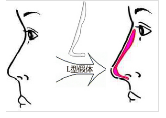 /Public/ueditor/php/upload/image/20181030/1540888388893879.png