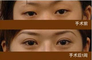 /Public/ueditor/php/upload/image/20181105/1541388069723446.png