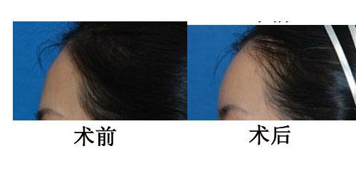 /Public/ueditor/php/upload/image/20181114/1542162105307059.jpg