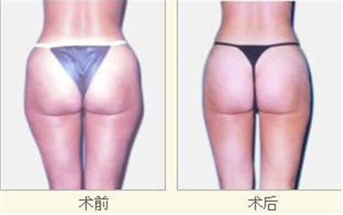 /Public/ueditor/php/upload/image/20181114/1542177843772266.jpg