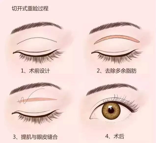 /Public/ueditor/php/upload/image/20181115/1542249183716739.jpeg